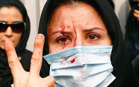 زنی زجر دیده، برای گرفتن حقوق ازدست رفته خود، این چنین مجروح و خون آلود می شود