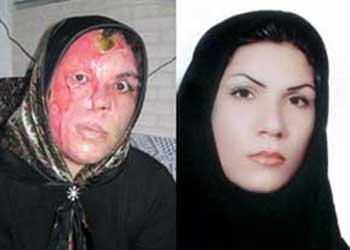 هر هفته چندین مورد اسیدپاشی اتفاق می افتد، هر هفته چند زن و دختر زیبایی و سلامت و حتی جان خویش را برای "نه" گفتن به درخواست مردی از دست می دهد. زنان در ایران از کمترین حد امنیت اجتماعی برخوردار نیستند.
