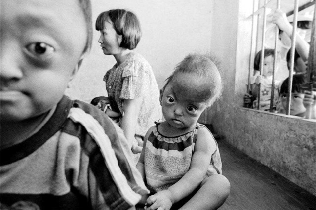 پیامد بمب های شیمیایی آمریکا بر روی مردم بی دفاع ویتنام به هم خوردن و دگرگونی جسم و روان مادران است که چنین فرزندان ناسالم و با اندامی نا موزون به وجود می آورند.