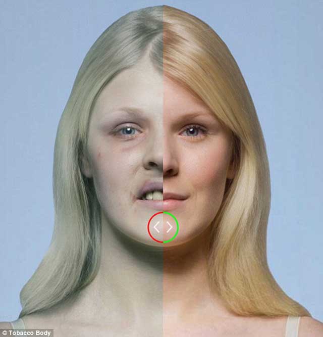 در این فرتور تفاوت میان چهره یک فرد سالم و یک سیگاری به خوبی دیده می شود. پیامد سیگار کشیدن به دلیل اختلال و نارسایی در جریان خون، قدرت دفاعی بدن کاهش می یابد و بیماری های پوستی و لکه لکه شدن صورت را  را به دنبال خواهد داشت.