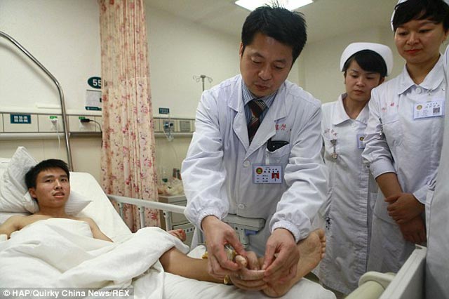 در این تصویر، پزشکان چکونگی واکنش پنجه پیوند شده به پا را پیوسته زیر نظر دارند و معاینه می کنند.