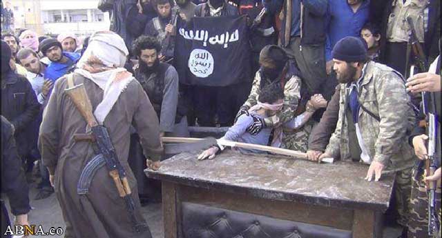گروه داعش در سوریه و عراق جنایات بیشماری را بنام اسلام و با قانون شریعت اجراء کردند. در این فرتور قطع دست یک فرد را نشان می دهد.