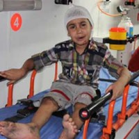 امیر حسین کودک ۶ ساله ای که بازمانده این تصاد خونین است. تصادفی که در آن ۴۳ نفر، نیمی از مسافرین دو اتوبوس سوختند.