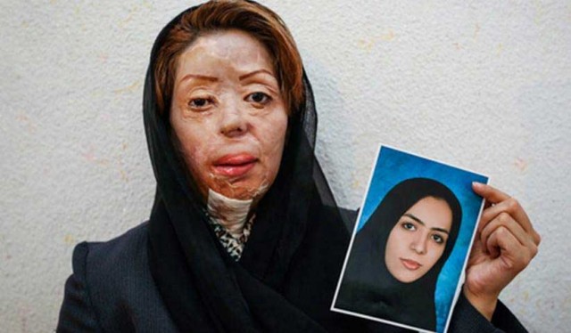 رژیم زن ستیز و زن کش، پس از اسید پاشی بر زنان اصفهان ریحانه را نیز